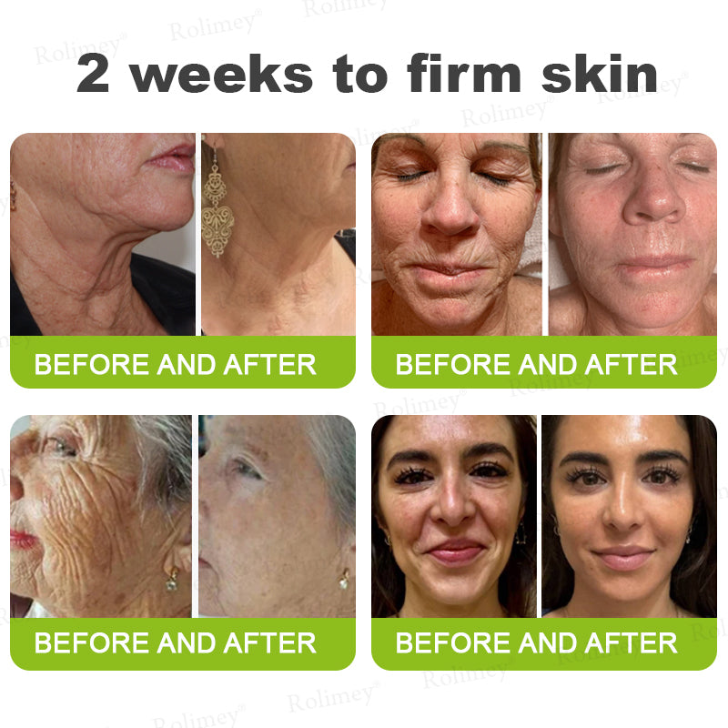 💞Made and shipped from the USA 💫Rolimey® Botox & Vita-A Retinol Shot Wrinkle-Lift Tightening cream - Last Day Promotion 70% OFF