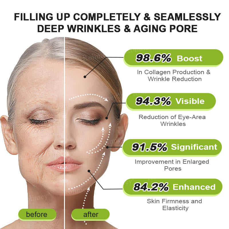 💞Made and shipped from the USA 💫Rolimey® Botox & Vita-A Retinol Shot Wrinkle-Lift Tightening cream - Last Day Promotion 70% OFF