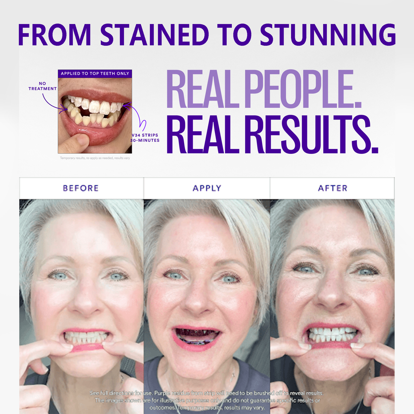 ❣️hismlle™ V36 Whitening Strips – Professional Teeth Whitening at Home(UPGRADED VERSION)（upsell ）