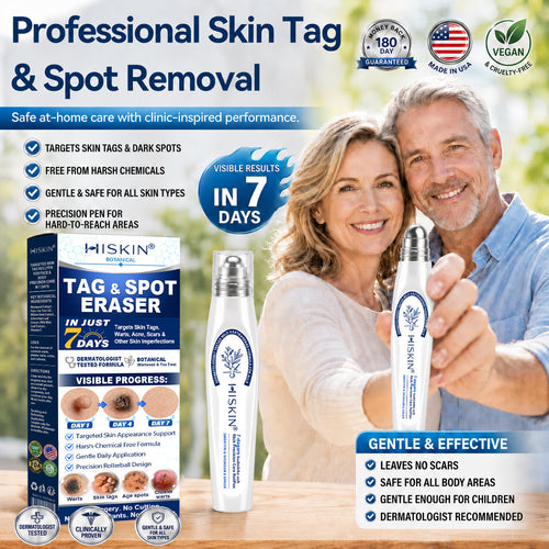 🏥👩‍⚕️Remifa®✨ 𝟕-𝐃𝒂𝘆 𝐒𝗸𝐢𝐧 𝐓𝒂𝗴 & 𝐒𝐩o𝐭 𝐄𝐫𝒂𝐬𝙚𝐫 𝐏𝐚𝐢𝐧𝐥𝐞𝐬𝐬 & 𝐒𝐜𝐚𝐫-𝐅𝐫𝐞𝐞 𝐀𝐝𝐯𝐚𝐧𝐜𝐞𝐝 𝐈𝐦𝐩𝐞𝐫𝐟𝐞𝐜𝐭𝐢𝐨𝐧 𝐑𝐞𝐦𝐨𝐯𝐚𝐥 𝐑𝐨𝐥𝐥𝐞𝐫𝐛𝐚𝐥𝐥 𝐏𝐞𝐧