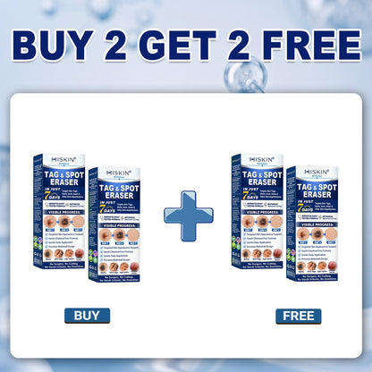 🏥👩‍⚕️Remifa®✨ 𝟕-𝐃𝒂𝘆 𝐒𝗸𝐢𝐧 𝐓𝒂𝗴 & 𝐒𝐩o𝐭 𝐄𝐫𝒂𝐬𝙚𝐫 𝐏𝐚𝐢𝐧𝐥𝐞𝐬𝐬 & 𝐒𝐜𝐚𝐫-𝐅𝐫𝐞𝐞 𝐀𝐝𝐯𝐚𝐧𝐜𝐞𝐝 𝐈𝐦𝐩𝐞𝐫𝐟𝐞𝐜𝐭𝐢𝐨𝐧 𝐑𝐞𝐦𝐨𝐯𝐚𝐥 𝐑𝐨𝐥𝐥𝐞𝐫𝐛𝐚𝐥𝐥 𝐏𝐞𝐧