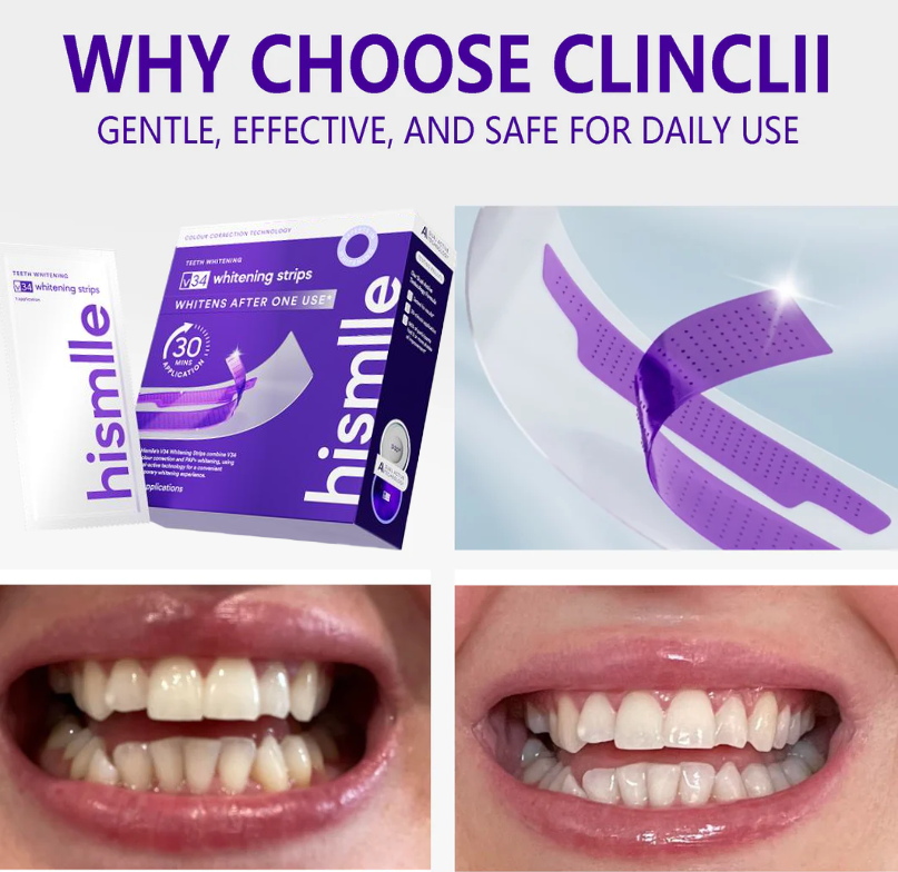 ❣️hismlle™ V36 Whitening Strips – Professional Teeth Whitening at Home(UPGRADED VERSION)（upsell ）