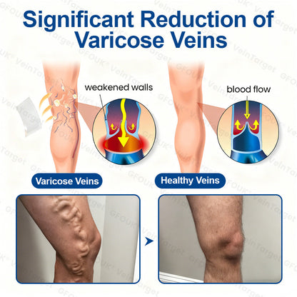 🇺🇸👨‍⚕️🦵✅GFOUK® VeinTarget Microneedle Patch⚡Instant Relief, Long-Term Results