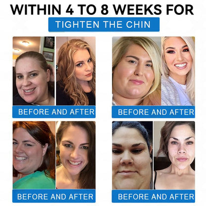 【Last Day Promotion 80% OFF🌟】✨ Evolvion® 𝐓𝐢𝐫𝐳𝐞𝐩𝐚𝐭𝐢𝐝𝐞 & 𝐂𝐨𝐥𝐥𝐚𝐠𝐞𝐧 𝐍𝐚𝐧𝐨 𝐌𝐢𝐜𝐫𝐨𝐧𝐞𝐞𝐝𝐥𝐞 𝐖𝐞𝐢𝐠𝐡𝐭 𝐋𝐨𝐬𝐬 𝐏𝐚𝐭𝐜𝐡丨Targets Obesity, Loose Skin, High Blood Pressure, Diabetes, Fatty Liver, Joint Pain, Brain Fog, Low Energy, Body Aches, and More