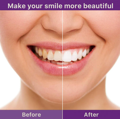❣️hismlle™ V36 Whitening Strips – Professional Teeth Whitening at Home(UPGRADED VERSION)（upsell ）